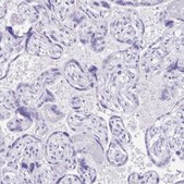 Anti-DEFA5 antibody produced in rabbit Prestige Antibodies® Powered by Atlas Antibodies, affinity isolated antibody, buffered aqueous glycerol solution