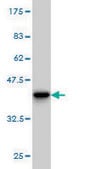 Monoclonal Anti-S100A7 antibody produced in mouse clone 3A5, purified immunoglobulin, buffered aqueous solution
