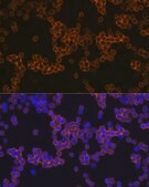 Anti-CD14 antibody produced in rabbit
