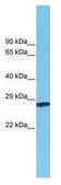 Anti-CD63 (C-terminal) antibody produced in rabbit affinity isolated antibody