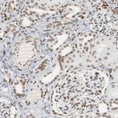 Anti-PRKAG2 antibody produced in rabbit Prestige Antibodies® Powered by Atlas Antibodies, affinity isolated antibody, buffered aqueous glycerol solution