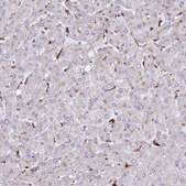 Anti-SRD5A1 antibody produced in rabbit Prestige Antibodies® Powered by Atlas Antibodies, affinity isolated antibody, buffered aqueous glycerol solution