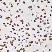 Anti-Phospho-STAT5A-Y694 antibody produced in rabbit