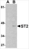抗-ST2 兔抗 affinity isolated antibody, buffered aqueous solution