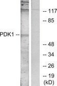 Anti-PDK1 antibody produced in rabbit affinity isolated antibody