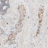 Anti-IL1RL1 antibody produced in rabbit Ab2, Prestige Antibodies® Powered by Atlas Antibodies, affinity isolated antibody, buffered aqueous glycerol solution