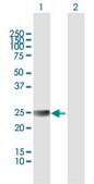 Anti-ETHE1 antibody produced in mouse IgG fraction of antiserum, buffered aqueous solution