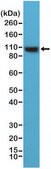 Anti-Alpha Actinin-4 antibody, Rabbit Monoclonal recombinant, expressed in HEK 293 cells, clone RM287, purified immunoglobulin
