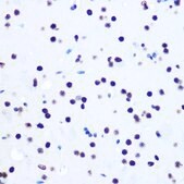 Anti-Histone H2AX antibody produced in rabbit