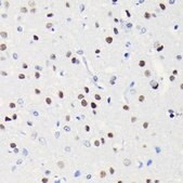 Anti-BRG1/SMARCA4 antibody produced in rabbit