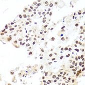 Anti- HIRA antibody produced in rabbit