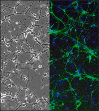 Rat Striatal Neurons: RStN