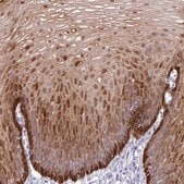 抗-ALDH3A1 兔抗 Prestige Antibodies® Powered by Atlas Antibodies, affinity isolated antibody, buffered aqueous glycerol solution