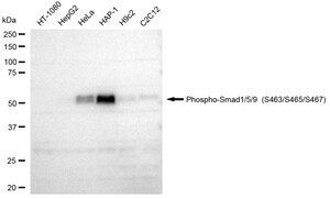 Anti-phospho-Smad1/5/9 (Ser463/Ser465/Ser467) Antibody, clone 23GB4155, Rabbit Monoclonal clone 23GB4155, recombinant rabbit monoclonal, expressed in HEK293 cells