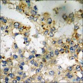 Anti-phospho-LATS1/2 (pThr1079/1041) antibody produced in rabbit affinity isolated antibody