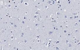 Anti-ADAR1 Antibody, clone 1I4-H1 ZooMAb® Rabbit Monoclonal recombinant, expressed in HEK 293 cells