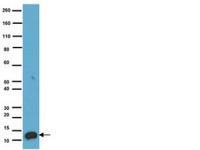 Anti-S-100 Protein Antibody, clone 15E2E2 clone 15E2E2, Chemicon®, from mouse