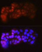Anti-ESRα Antibody, clone 4L8K5, Rabbit Monoclonal