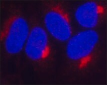 Anti-TIMP2 antibody, Mouse monoclonal clone TM8, purified from hybridoma cell culture