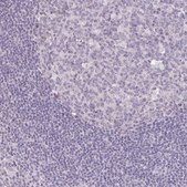 Anti-KIAA1210 antibody produced in rabbit Prestige Antibodies® Powered by Atlas Antibodies, affinity isolated antibody, buffered aqueous glycerol solution