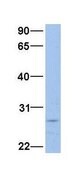 Anti-FTH1 affinity isolated antibody