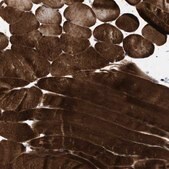 Anti-BAG3 antibody produced in rabbit Prestige Antibodies® Powered by Atlas Antibodies, affinity isolated antibody, buffered aqueous glycerol solution, Ab1