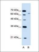 Anti-CBS antibody produced in rabbit IgG fraction of antiserum