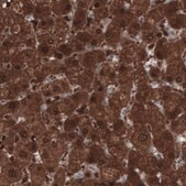 Monoclonal Anti-PGM1 antibody produced in mouse Prestige Antibodies® Powered by Atlas Antibodies, clone CL3299, purified immunoglobulin, buffered aqueous glycerol solution