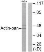 Anti-Actin-pan, C-Terminal antibody produced in rabbit affinity isolated antibody