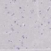Anti-PDE6A antibody produced in rabbit Prestige Antibodies® Powered by Atlas Antibodies, affinity isolated antibody