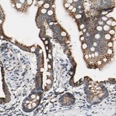 Anti-CLPP antibody produced in rabbit Prestige Antibodies® Powered by Atlas Antibodies, affinity isolated antibody, buffered aqueous glycerol solution