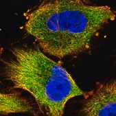 Anti-NDUFAF1 antibody produced in rabbit Prestige Antibodies® Powered by Atlas Antibodies, affinity isolated antibody, buffered aqueous glycerol solution