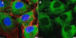 Anti-MICU1 Antibody, clone 1H13 ZooMAb® Rabbit Monoclonal recombinant, expressed in HEK 293 cells