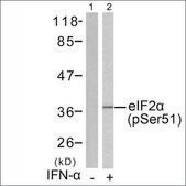 Anti-phospho-EIF2S1 (pSer51) antibody produced in rabbit affinity isolated antibody