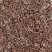 Monoclonal Anti-NEFM antibody produced in mouse Prestige Antibodies® Powered by Atlas Antibodies, clone CL2678, purified immunoglobulin, buffered aqueous glycerol solution