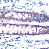 Anti-Occludin antibody produced in rabbit