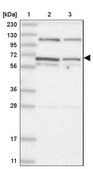 Anti-DIS3L2 antibody produced in rabbit Prestige Antibodies® Powered by Atlas Antibodies, affinity isolated antibody, buffered aqueous glycerol solution