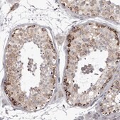 Anti-TUFM antibody produced in rabbit Prestige Antibodies® Powered by Atlas Antibodies, affinity isolated antibody, buffered aqueous glycerol solution