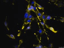 OSUMMER.9 Mouse NRAS-Mutant Melanoma Cell Line