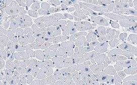 Anti-Ryanodine Receptor 2 Antibody, clone 2K6 ZooMAb® Rabbit Monoclonal recombinant, expressed in HEK 293 cells