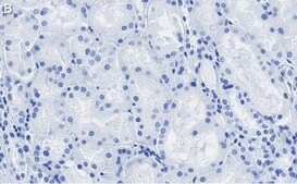 Anti-Occludin Antibody, clone 1C17 ZooMAb® Rabbit Monoclonal recombinant, expressed in HEK 293 cells