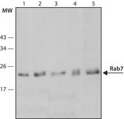 Anti-Rab7 antibody, Mouse monoclonal ~2 mg/mL, clone Rab7-117, purified from hybridoma cell culture