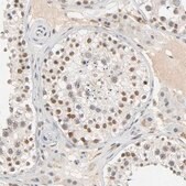 Anti-NCOA6 antibody produced in rabbit Prestige Antibodies® Powered by Atlas Antibodies, affinity isolated antibody, buffered aqueous glycerol solution