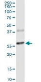 Monoclonal Anti-CTLA4 antibody produced in mouse clone 2F1, purified immunoglobulin, buffered aqueous solution