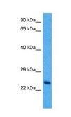 Anti-PLP1 (ab1) antibody produced in rabbit affinity isolated antibody