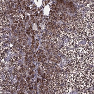Anti-Hdac5 Antibody Produced In Rabbit Prestige Antibodies® Powered by Atlas Antibodies, affinity isolated antibody, buffered aqueous glycerol solution