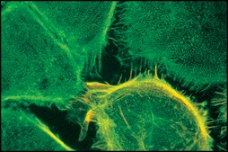 单克隆抗 α-辅肌动蛋白 小鼠抗 clone BM-75.2, ascites fluid