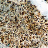 Anti-phospho-Smad3 (pSer213) antibody produced in rabbit affinity isolated antibody