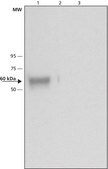 Anti-Glucocerebrosidase antibody produced in rabbit ~1 mg/mL, affinity isolated antibody, buffered aqueous solution