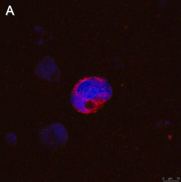 Anti-IFN&#947; Antibody, clone 5K15 ZooMAb&#174; Rabbit Monoclonal recombinant, expressed in HEK 293 cells